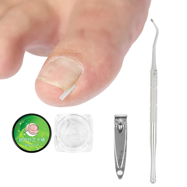 Professionele Ingegroeide Teennagel Correctie Behandelingsset