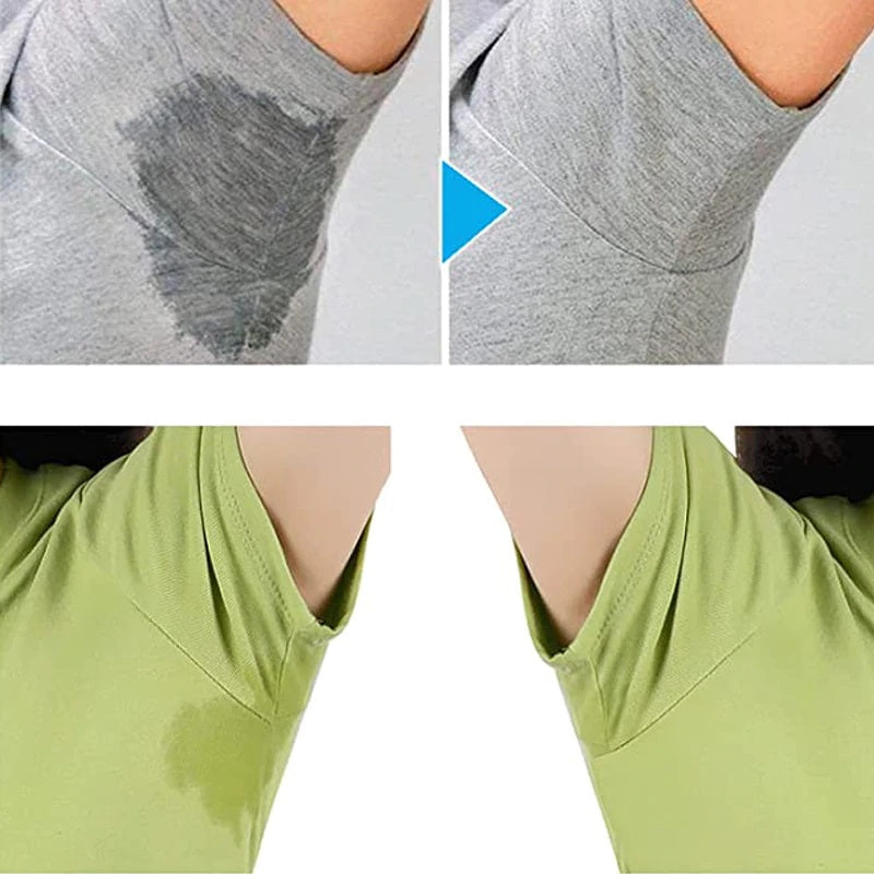 Anti Zweet Pads™ (10 Stuks)