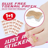 Anti-Ingroei Nagel Stickers (Tijdelijk 1 + 1 Gratis)