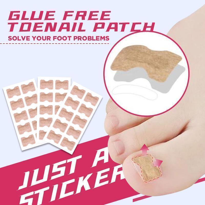 Anti-Ingroei Nagel Stikkers (Tijdelijk 50% Korting!)