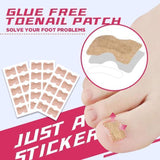 Anti-Ingroei Nagel Stikkers (Tijdelijk 50% Korting!)