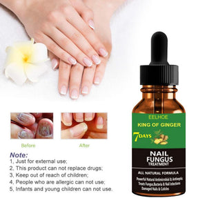 Natuurlijk Anti-Schimmelnagel Serum