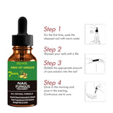 Natuurlijk Anti-Schimmelnagel Serum