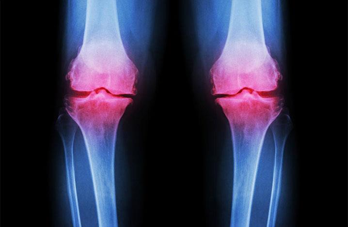 PowerKnee Brace™ ( 2 stuks )