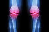 PowerKnee Brace™ ( 2 stuks )
