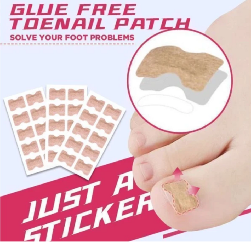 Monaky® Anti-ingroei  Nagel Stickers (Tijdelijk 50% Korting)