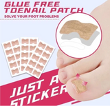 Monaky® Anti-ingroei  Nagel Stickers (Tijdelijk 50% Korting)