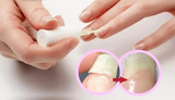 Nagel Versterk & Reparatie Lak "Perfect Protection"