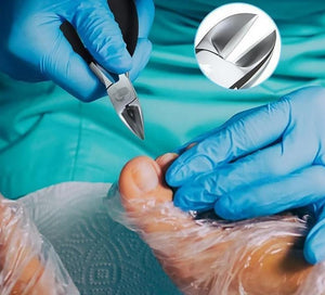 Professioneel Teennagel Schaartje™ | Ook tegen Ingegroeide Teennagels!