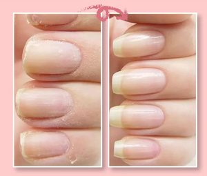 Nagel Versterk & Reparatie Lak "Perfect Protection"