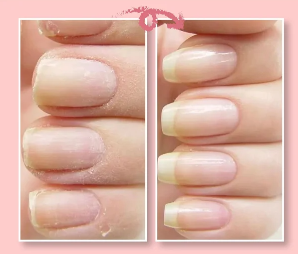 Nagel Versterk & Reparatie Lak "Perfect Protection"