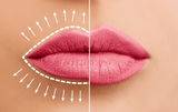 Volle Lippen Serum "Beauty Deluxe"