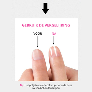 Multifunctionele Nano Polijst vijl (Tijdelijk 50% Korting)